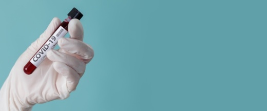Two mobile testing sites for the new coronavirus will begin testing registered residents April 14 and 20, respectively, Harris County Precinct 4 Commissioner Jack Cagle announced in a news release April 13. (Courtesy Adobe Stock)