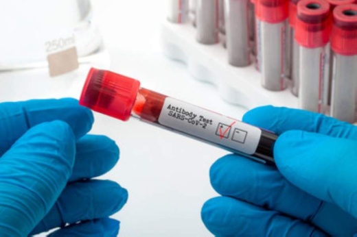 The Williamson County Commissioners Court approved the purchase of antibody coronavirus tests for first responders May 12. (Courtesy Adobe Stock)