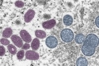 Monkeypox virus particles 
