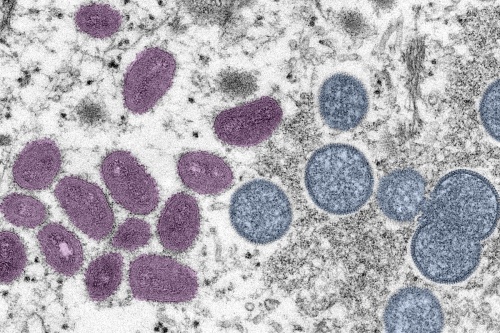 This digitally colorized electron microscopic image depicts monkeypox virus particles, obtained from a clinical sample associated with a 2003 outbreak. (Courtesy Cynthia S. Goldsmith and Russell Regnery via Centers for Disease Control and Prevention)