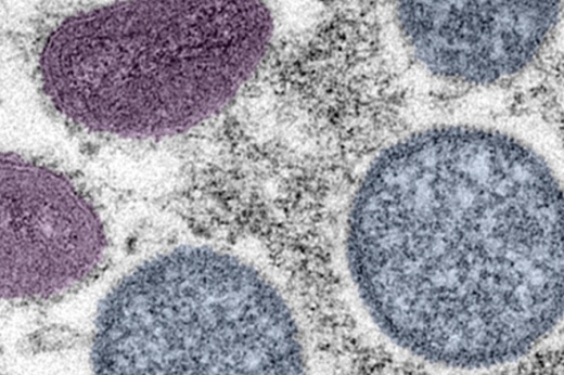 The San Antonio Metropolitan Health District on July 14 reported the first two official, confirmed cases of the monkeypox virus in Bexar County. (Courtesy Centers for Disease Control and Prevention)