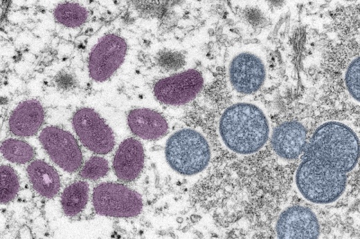 A purple and blue image of the monkeypox virus