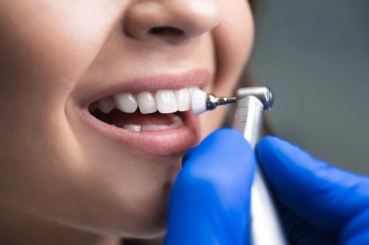 Stock image of patient receiving dental services