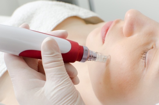 MV Skin Consulting offers holistic wellness treatments for teenage acne. (Courtesy Adobe Stock)