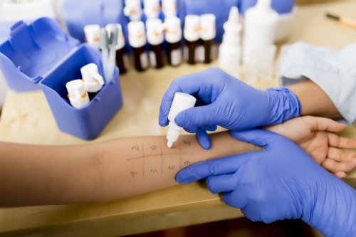 Allergy - skin prick tests