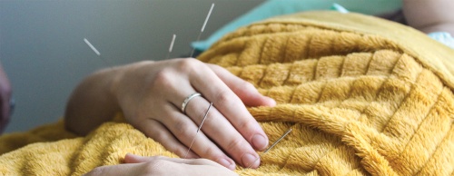Owner Noa Lynne Davis said hands are one of the most common areas she applies needles during her customersu2019 acupuncture treatments.