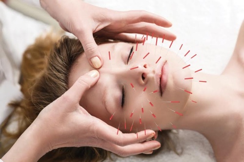 Withee Acupuncture will open a location in Frisco.