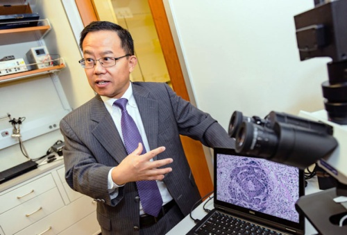 Bioengineering professor Baowei Fei is developing a noninvasive smart surgical microscope that could predict the presence of cancer cells during surgery with up to 90% accuracy.